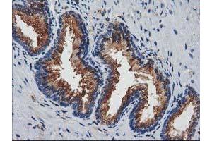 Immunohistochemical staining of paraffin-embedded Human prostate tissue using anti-JOSD1 mouse monoclonal antibody.