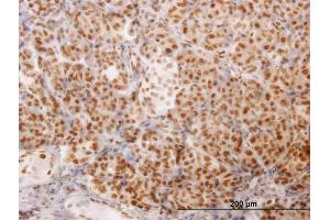 Immunoperoxidase of monoclonal antibody to NCOA4 on formalin-fixed paraffin-embedded human pancreas. (NCOA4 antibody  (AA 505-614))
