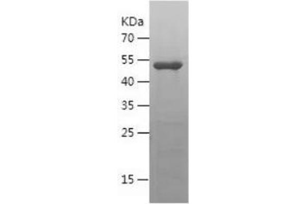 CHMP2B Protein (AA 1-213) (His-IF2DI Tag)