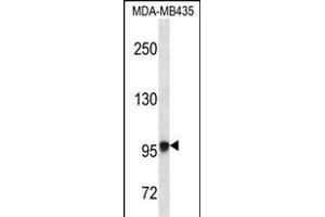 EXTL3 Antibody (N-term) (ABIN656662 and ABIN2845903) western blot analysis in MDA-M cell line lysates (35 μg/lane). (EXTL3 antibody  (N-Term))
