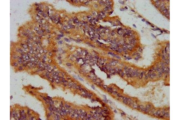 AS3MT antibody  (AA 262-375)