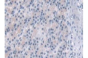 Detection of PDE4B in Rat Stomach Tissue using Polyclonal Antibody to Phosphodiesterase 4B, cAMP Specific (PDE4B) (PDE4B antibody  (AA 500-736))