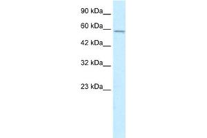 WB Suggested Anti-MGC4618 Antibody Titration:  0. (TMEM175 antibody  (N-Term))