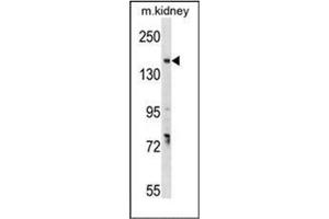 Western blot analysis of GREB1 Antibody  in mouse kidney tissue lysates (35ug/lane). (GREB1 antibody  (Middle Region))