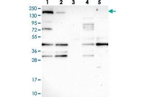 Western blot analysis of Lane 1: RT-4, Lane 2: U-251 MG, Lane 3: Human Plasma, Lane 4: Liver, Lane 5: Tonsil with SH3TC1 polyclonal antibody . (SH3TC1 antibody)