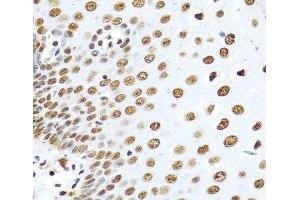 Immunohistochemistry of paraffin-embedded Human esophagus using HNRNPR Polyclonal Antibody at dilution of 1:100 (40x lens). (HNRNPR antibody)