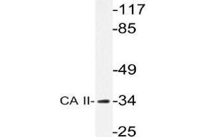 Western blot analysis of Carbonic anhydrase 2 antibody in extracts from rat heart cells. (CA2 antibody)