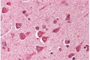 Human Brain, Cortex (formalin-fixed, paraffin-embedded) stained with ING1 antibody ABIN290441 at 2. (ING1 antibody  (AA 285-296))