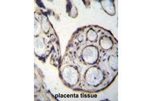 CAPN6 Antibody (Center) immunohistochemistry analysis in formalin fixed and paraffin embedded human placenta tissue followed by peroxidase conjugation of the secondary antibody and DAB staining. (Calpain 6 antibody  (Middle Region))