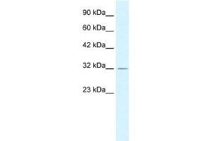 WB Suggested Anti-PSMD14 Antibody Titration:  0.