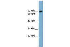 Image no. 1 for anti-Amyloid beta (A4) Precursor Protein-Binding, Family B, Member 1 Interacting Protein (APBB1IP) (AA 71-120) antibody (ABIN6744167) (Amyloid beta (A4) Precursor Protein-Binding, Family B, Member 1 Interacting Protein (APBB1IP) (AA 71-120) antibody)