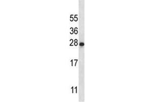 IL-22 antibody western blot analysis in K562 lysate (IL-22 antibody  (AA 44-73))