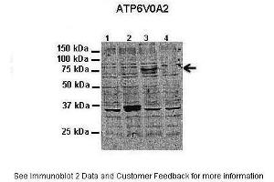 Application: Western blotting Species+tissue/cell type: HeLa cells How many ug'sof tissue/cell lysate run on the gel:1. (ATP6V0A2 antibody  (N-Term))