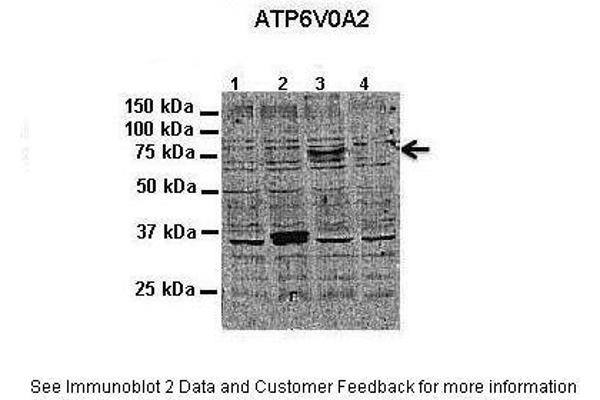 ATP6V0A2 antibody  (N-Term)