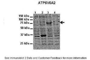 ATP6V0A2 antibody  (N-Term)