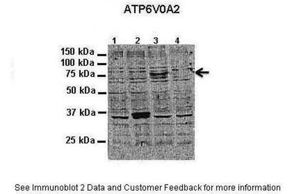 ATP6V0A2 Antikörper  (N-Term)