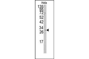 Image no. 1 for anti-Prohibitin (PHB) (C-Term), (Middle Region) antibody (ABIN357838) (Prohibitin antibody  (C-Term, Middle Region))