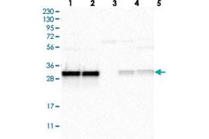 Western blot analysis of Lane 1: RT-4, Lane 2: U-251 MG, Lane 3: Human Plasma, Lane 4: Liver, Lane 5: Tonsil with MRPL45 polyclonal antibody  at 1:250-1:500 dilution. (MRPL45 antibody)