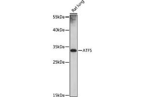 Western blot analysis of extracts of rat lung, using  antibody (ABIN7265407) at 1:1000 dilution. (ATF5 antibody)