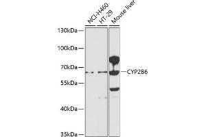 Western blot analysis of extracts of various cell lines, using CYP2B6 antibody (ABIN1679474, ABIN5663912, ABIN5663914 and ABIN6218554) at 1:1000 dilution. (CYP2B6 antibody  (AA 160-340))