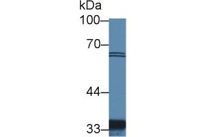 Detection of SLC30A8 in Human Hela cell lysate using Polyclonal Antibody to Solute Carrier Family 30 Member 8 (SLC30A8) (SLC30A8 antibody  (AA 263-369))