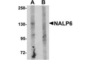 Western blot analysis of NALP5 in mouse brain tissue lysate with NALP5 antibody at 1 μg/ml in (A) the absence and (B) the presence of blocking peptide. (NLRP6 antibody  (N-Term))
