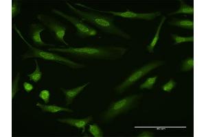 Immunofluorescence (IF) image for anti-Dual-Specificity tyrosine-(Y)-phosphorylation Regulated Kinase 1B (DYRK1B) (AA 479-569) antibody (ABIN522612)