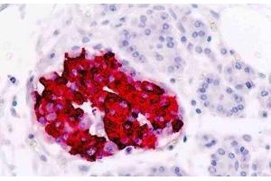 Human Pancreas, Islets of Langerhans: Formalin-Fixed, Paraffin-Embedded (FFPE) (Insulin antibody)