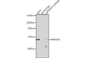 Immunoprecipitation analysis of 200 μg extracts of HeLa cells, using 3 μg  antibody (ABIN1678739, ABIN3018026, ABIN3018027 and ABIN6220339). (ARHGAP1 antibody  (AA 210-439))