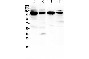 Western blot analysis of VCAM1 using anti-VCAM1 antibody . (VCAM1 antibody  (AA 25-270))