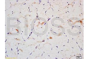 Formalin-fixed and paraffin embedded: rat skeletal muscle labeled with Anti-IRS2 Polyclonal Antibody (ABIN725840), Unconjugated at 1:200followed by conjugation to the secondary antibody and DAB staining (IRS2 antibody  (AA 501-600))