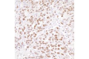 Immunohistochemistry (IHC) image for anti-Nuclear Casein Kinase and Cyclin-Dependent Kinase Substrate 1 (NUCKS1) (AA 147-197) antibody (ABIN7453492)