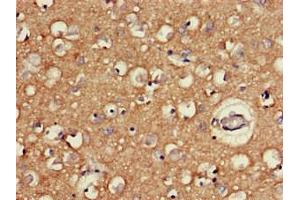 Immunohistochemistry of paraffin-embedded human brain tissue using ABIN7166533 at dilution of 1:100 (FAT3 antibody  (AA 1209-1470))