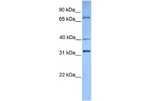 WB Suggested Anti-SUZ12 Antibody Titration:  0. (SUZ12 antibody  (Middle Region))