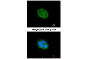 ICC/IF Image Immunofluorescence analysis of paraformaldehyde-fixed A431, using SPHK1, antibody at 1:200 dilution. (SPHK1 antibody  (C-Term))