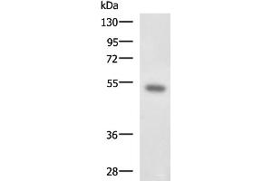 Western blot analysis of Mouse kidney tissue lysate using FOXQ1 Polyclonal Antibody at dilution of 1:650 (FOXQ1 antibody)