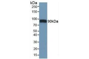 Detection of CD36 in Mouse Heart Tissue using Polyclonal Antibody to Cluster Of Differentiation 36 (CD36) (CD36 antibody  (AA 45-203))