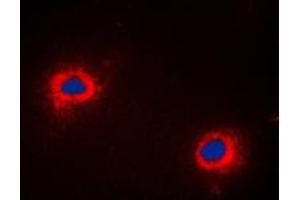 Immunofluorescent analysis of NIP1 staining in COLO205 cells. (BNIP1 antibody  (C-Term))