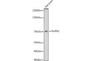 Western blot analysis of extracts of Rat brain, using NUP62 antibody (ABIN7269045) at 1:1000 dilution. (NUP62 antibody)