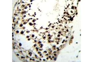 Immunohistochemistry (IHC) image for anti-Lin-28 Homolog A (C. Elegans) (LIN28A) (AA 108-138) antibody (ABIN3031626)