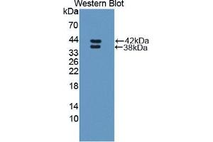 Western blot analysis of the recombinant protein. (RETNLB antibody  (AA 24-111))