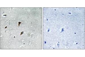 Immunohistochemistry analysis of paraffin-embedded human brain, using MAP2K3 (Phospho-Thr222) Antibody. (MAP2K3 antibody  (pThr222))