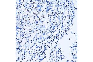 Immunohistochemistry of paraffin-embedded human tonsil using PARP1 antibody. (PARP1 antibody  (AA 81-390))