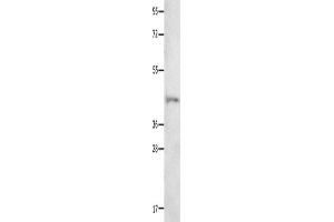 Western Blotting (WB) image for anti-Neurotensin Receptor 1 (High Affinity) (NTSR1) antibody (ABIN2426287)