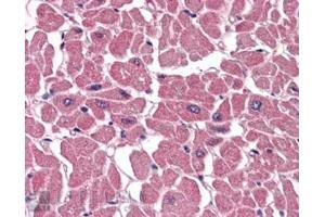 ABIN184640 (3. (ABTB1 antibody  (C-Term))