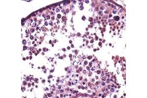 Immunohistochemistry (IHC) image for anti-Small Ubiquitin Related Modifier Protein 1 (SUMO1) (AA 1-30) antibody (ABIN3032639)