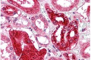 Human Kidney: Formalin-Fixed, Paraffin-Embedded (FFPE) (GM2A antibody  (N-Term))