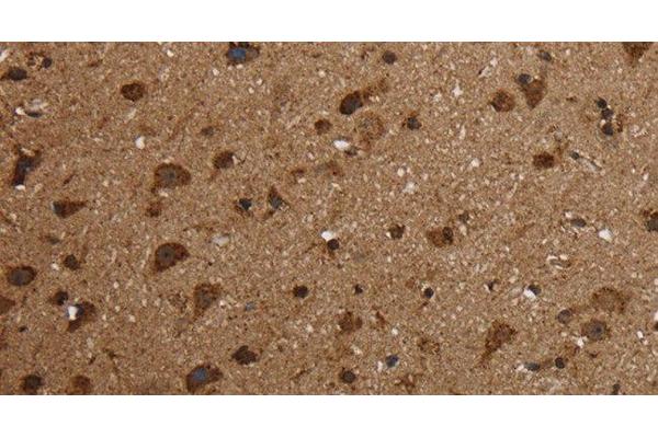HSD17B13 antibody