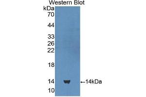 Western blot analysis of the recombinant protein. (CUBN antibody  (AA 3511-3623))