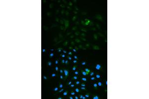 Immunofluorescence analysis of MCF7 cell using CD79B antibody. (CD79b antibody)